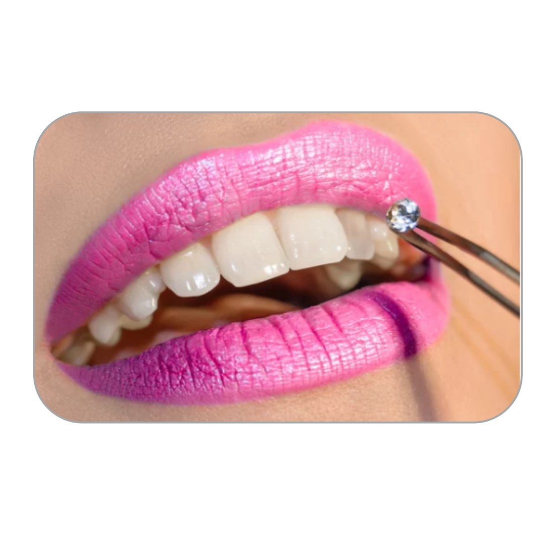 Dental Tooth Crystal