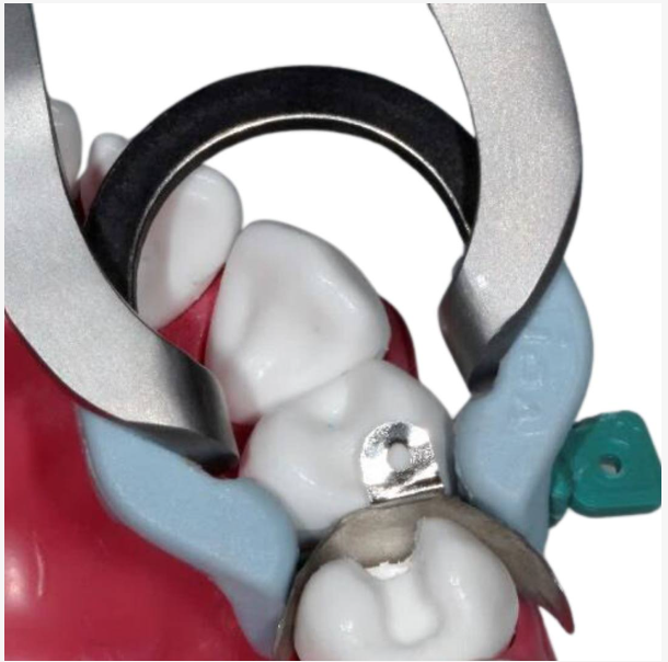 Vigor Universal Sectional Matrix Systems Ring Forceps