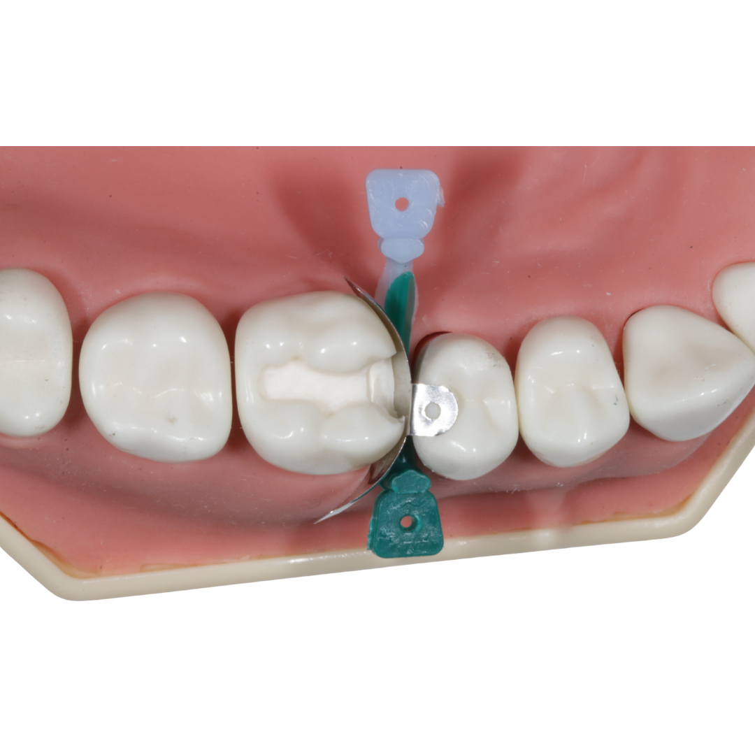 İda Pratiwedges Anatomical Dental Wedge